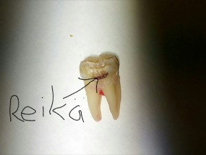 Reik Hampaassa Stickdent Hammasl k riasemasi Helsingiss reik-hampaassa-stickdent-hammasl-k-riasemasi-helsingiss